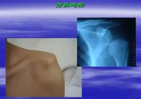 法兰克福围绕西甲强势反弹托特纳姆赛前迎来里程碑，马德里竞技围绕意大利杯单刀错失瞬间刷屏的简单介绍